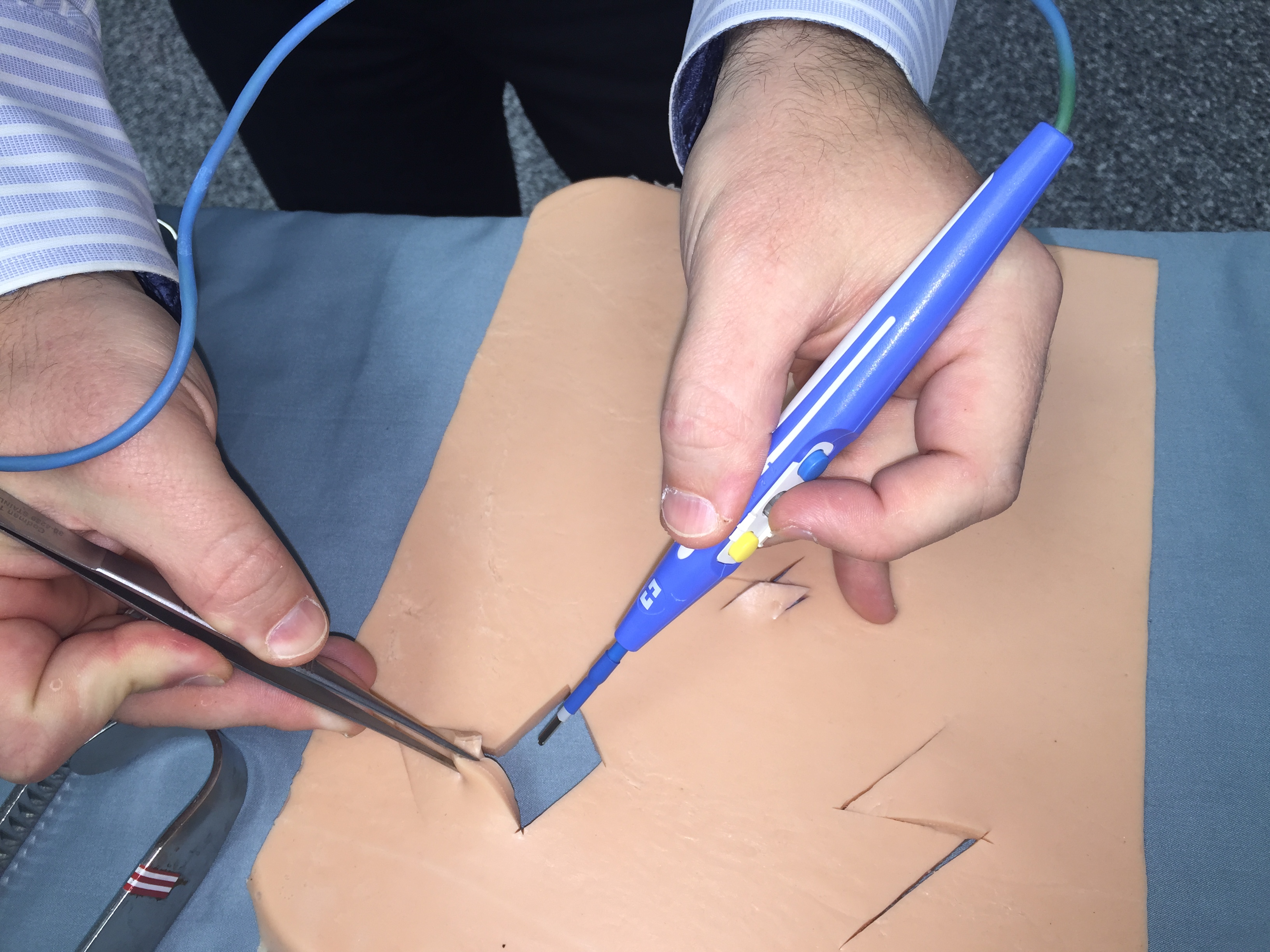 Electrocautery with pickups