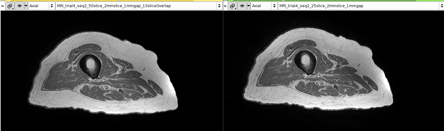 Comparison of seq#2 to seq#3