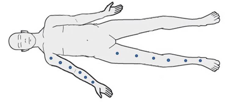 Anterior Positioning