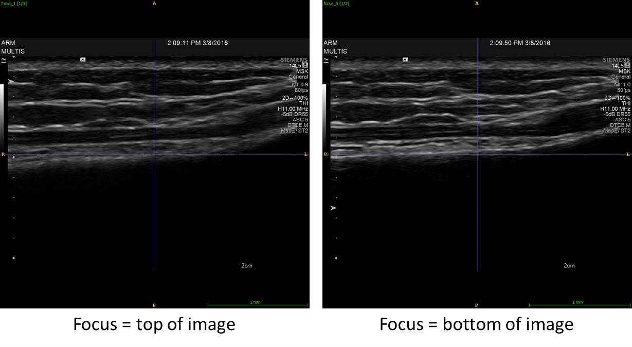 Focus Comparison