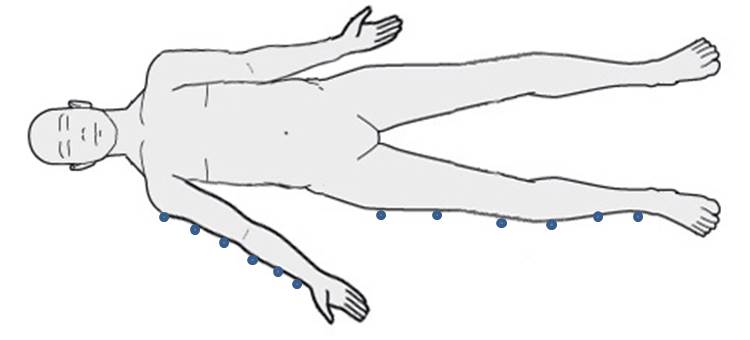 Lateral Positioning