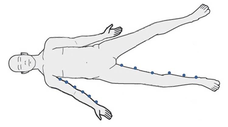 Medial Positioning