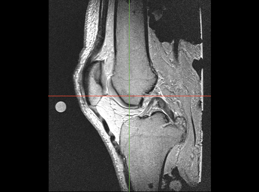 connective-tissue.png