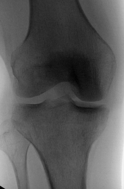 right-xray.png