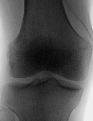 xray_oks005.png