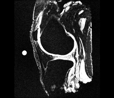 oks007 Cartilage Imaging