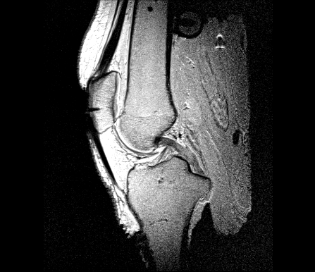 oks007 Connective Tissue Imaging