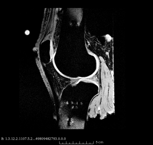 oks008 Cartilage Imaging