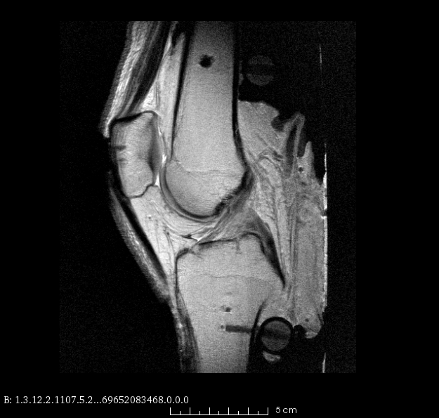 oks008 Connective Tissue Imaging