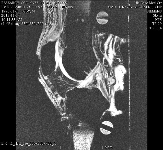 oks009 Cartilage Imaging