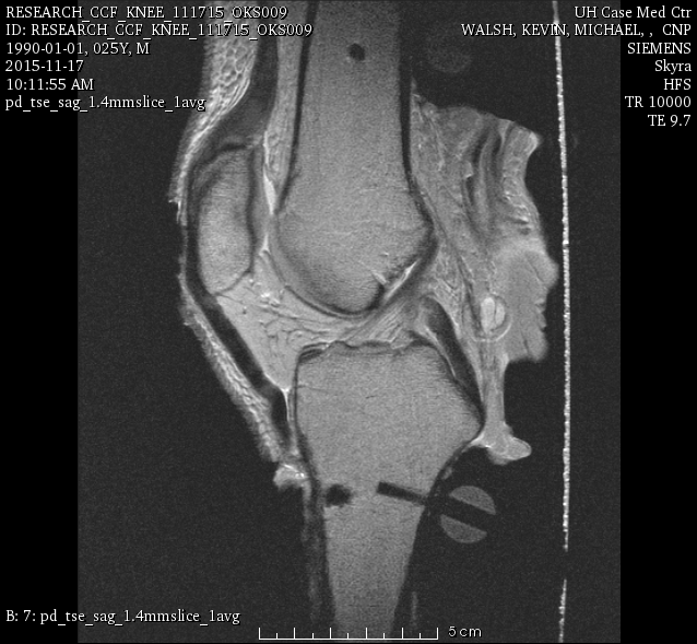 oks009 Connective Tissue Imaging