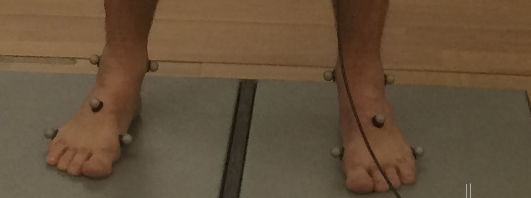 Picture of feet.JPG