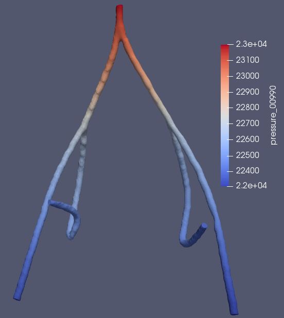 pressure map_990.JPG