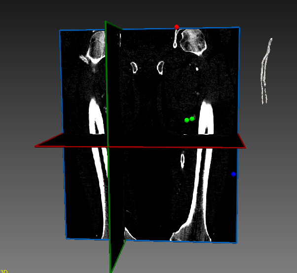 3Dview_simvascular.PNG