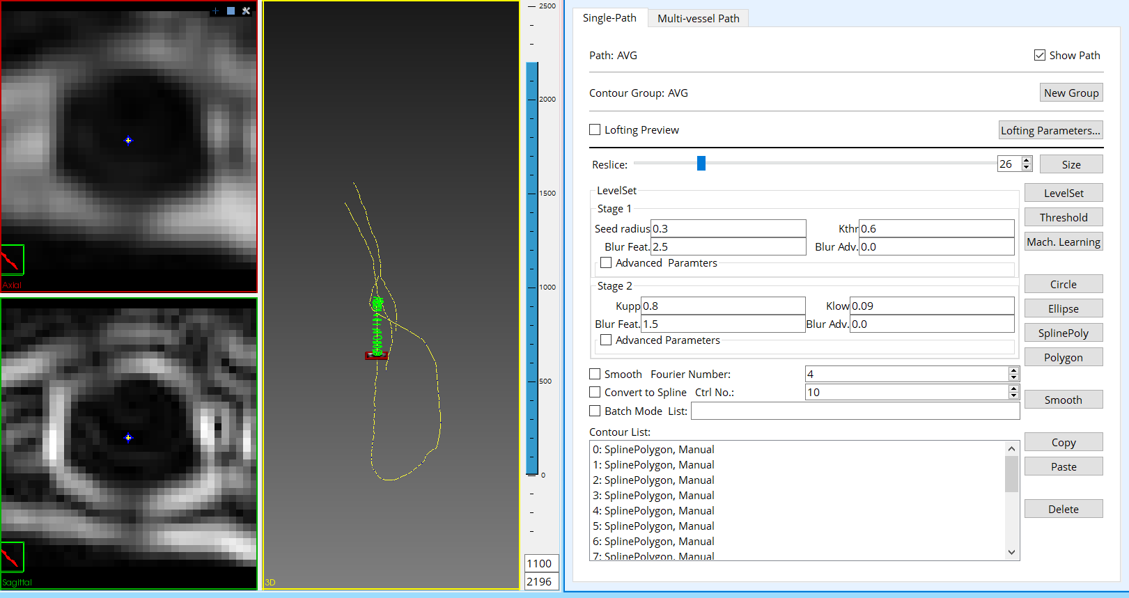 SimV_segmentation.PNG