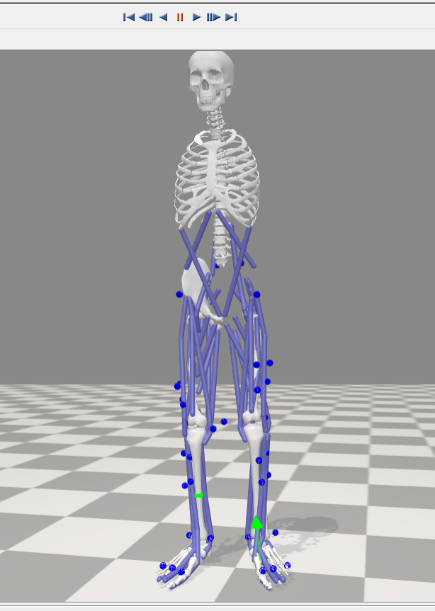 Scaling Old prosthesis.PNG